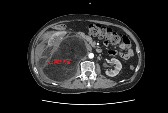 E:\2 微信\【临时 定期删】网站后台\640 (1).png